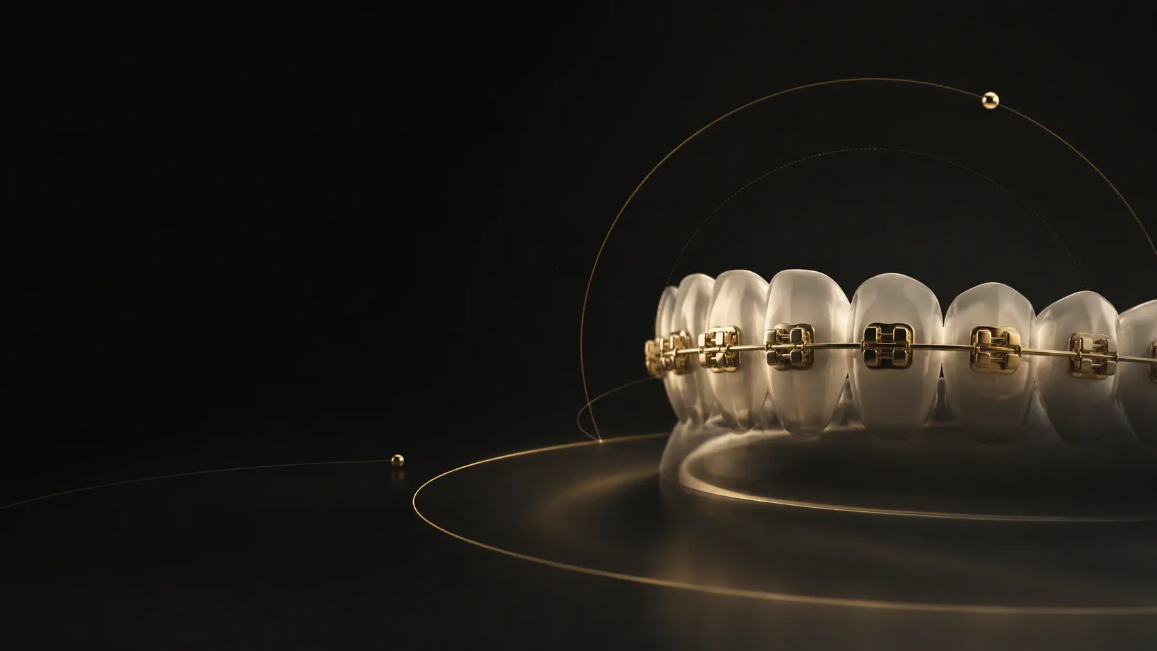 Representación premium de brackets dorados sobre una arcada dental